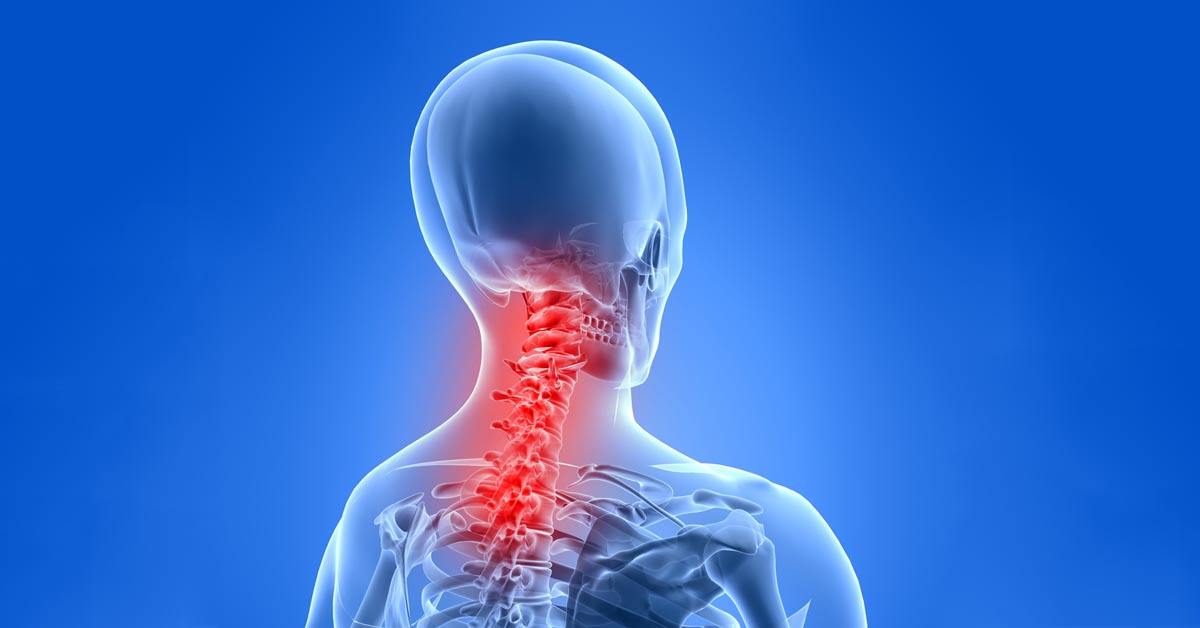Burke car accident and neck pain treatment